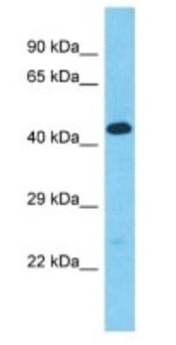 Golgin A6 Family-Like 2 Rabbit anti-Human, Polyclonal, Novus Biologicals:Antibodies:Primary